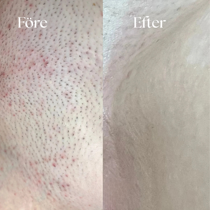 Ester - För en framtid utan engångsplast