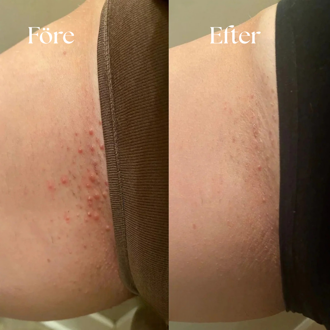 Ester - För en framtid utan engångsplast